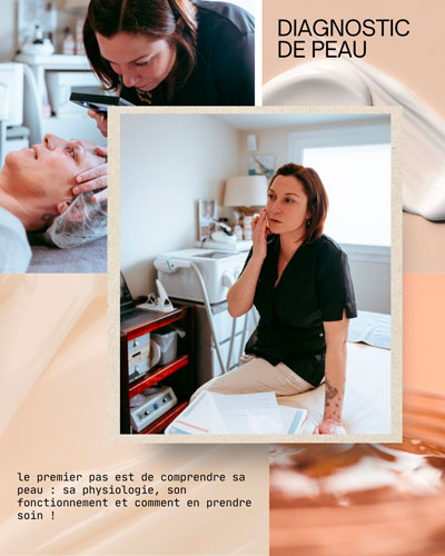 Diag de peau
